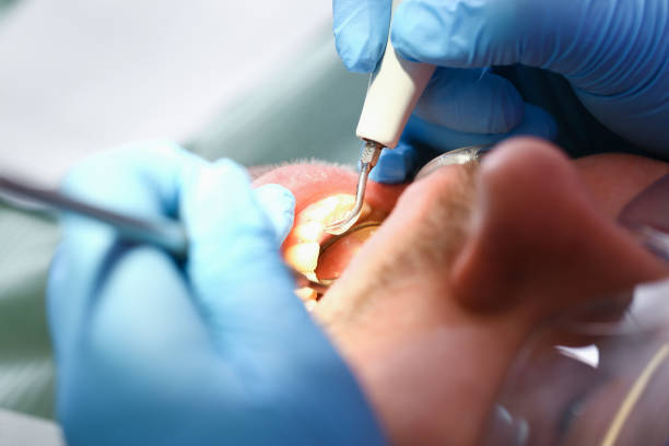 Best Emergency Treatment for Oral Infections in Ste Genevieve, MO