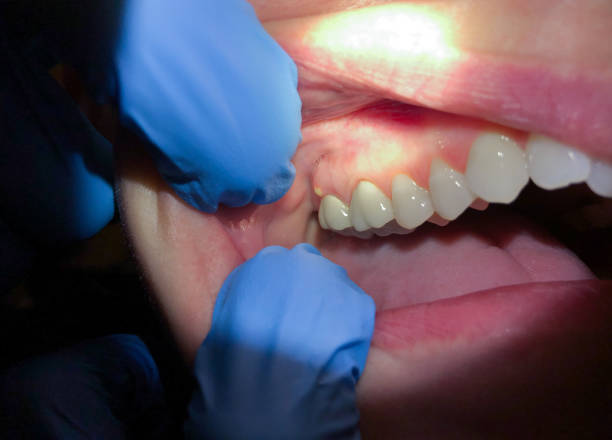Best After-Hours Dental Care in Ste Genevieve, MO